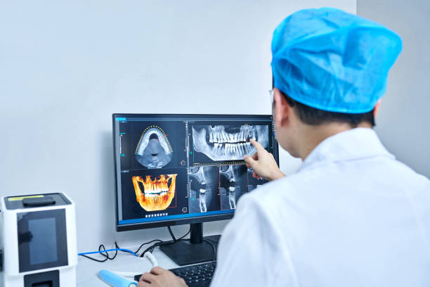 Best Emergency Dental Care for Broken or Chipped Teeth in Bristol, TN